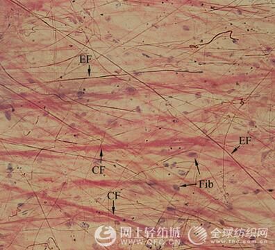 膠原纖維的特點:膠原纖維是由氨基酸多肽體構成的三維結構.